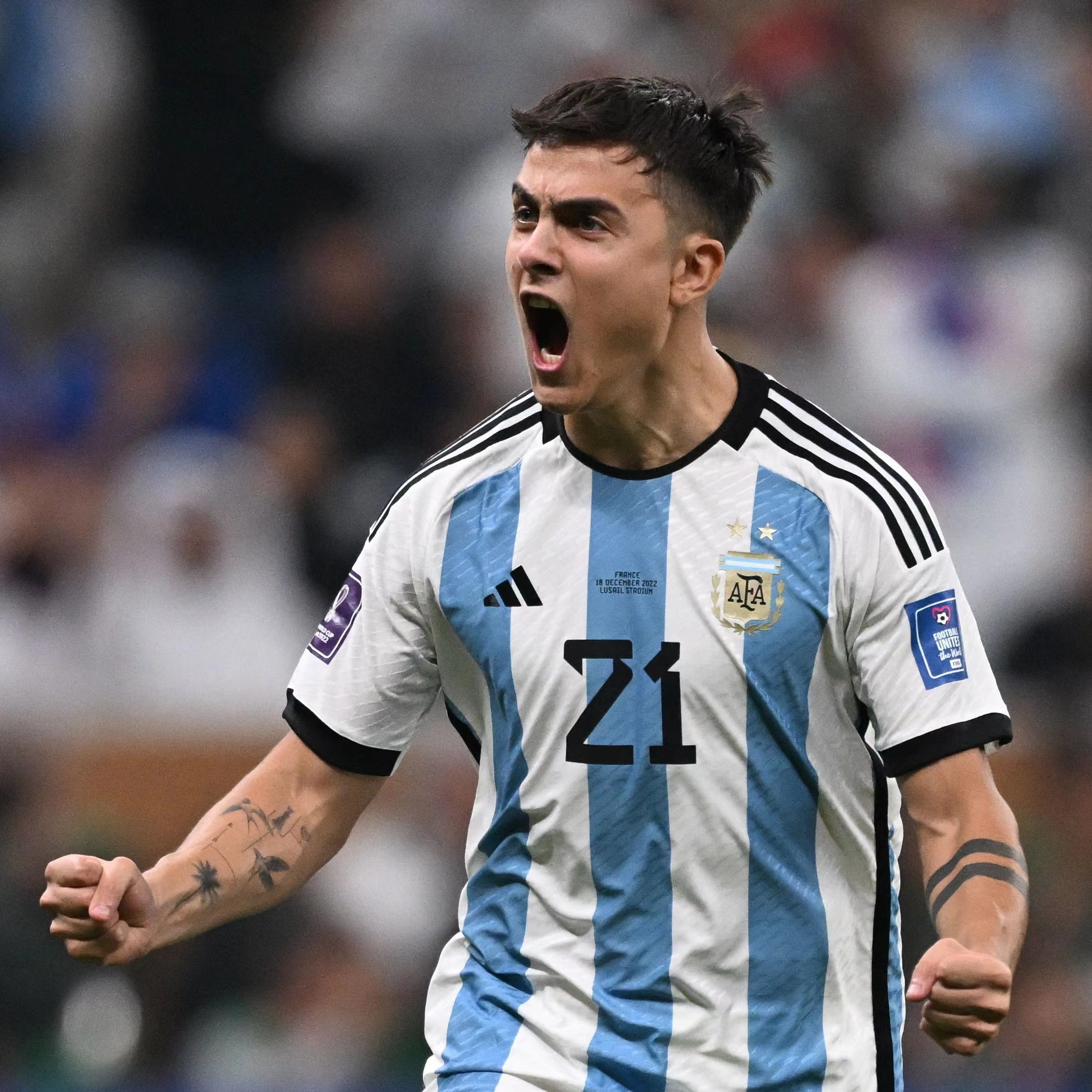 包含阿根廷球星迪巴拉受伤，缺席下一场欧冠的词条